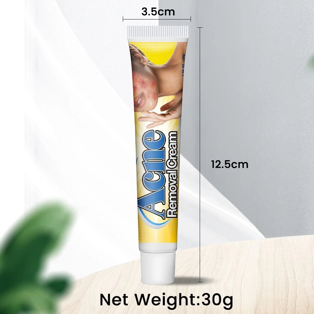 30g Acne Removal Cream Pimple Pits Pustule Deep Cleaning Face Repair Skin