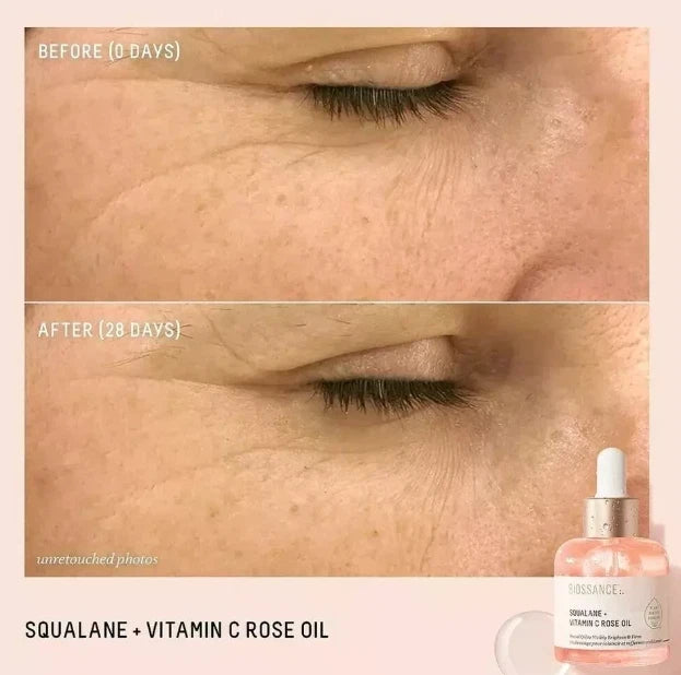 Biossance Squalane Vitamin C Rose Oil NEW 30ML BNIB [Free shipping UK]