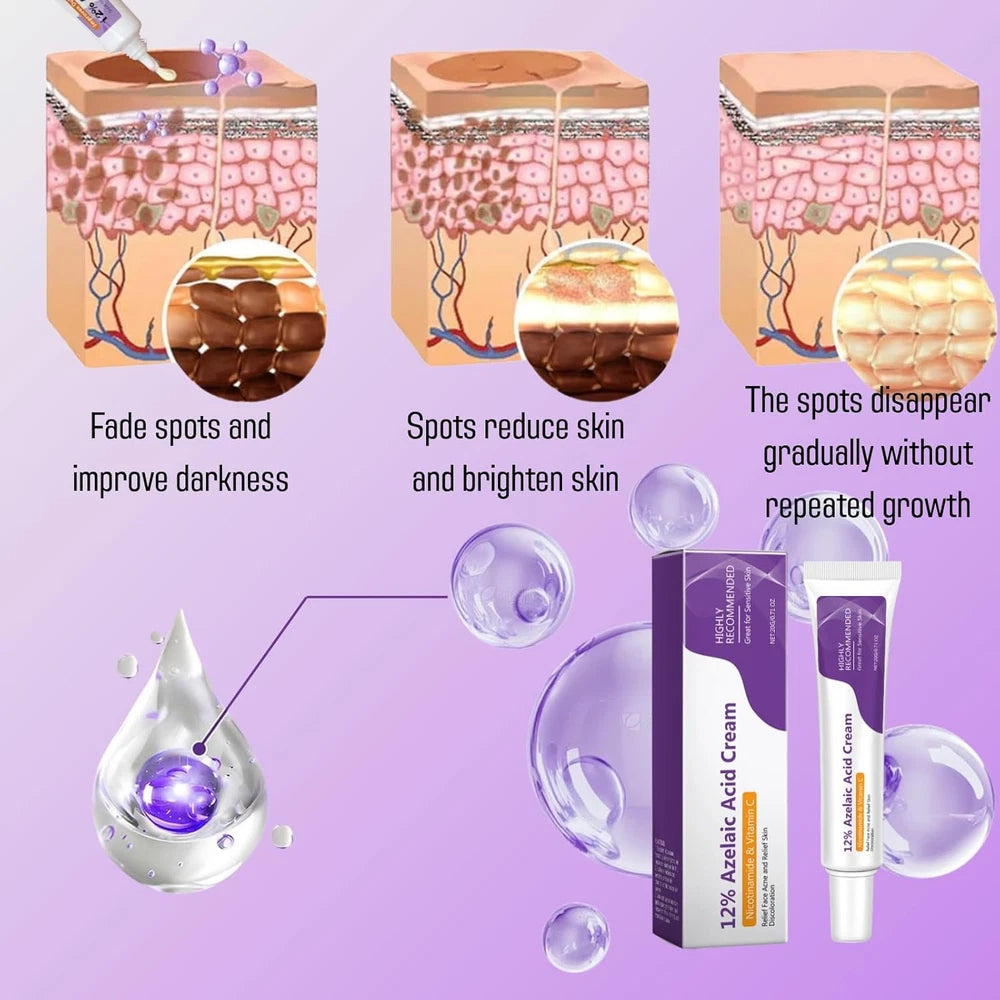 12% Aze-Laic Acid Acne Cream，Acne & Hyperpigmentation Treatment for Spot Prone