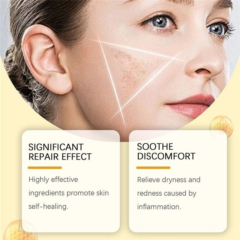 Bee venom skin treatment cream,  Bee Venom Skin Restoration Cream