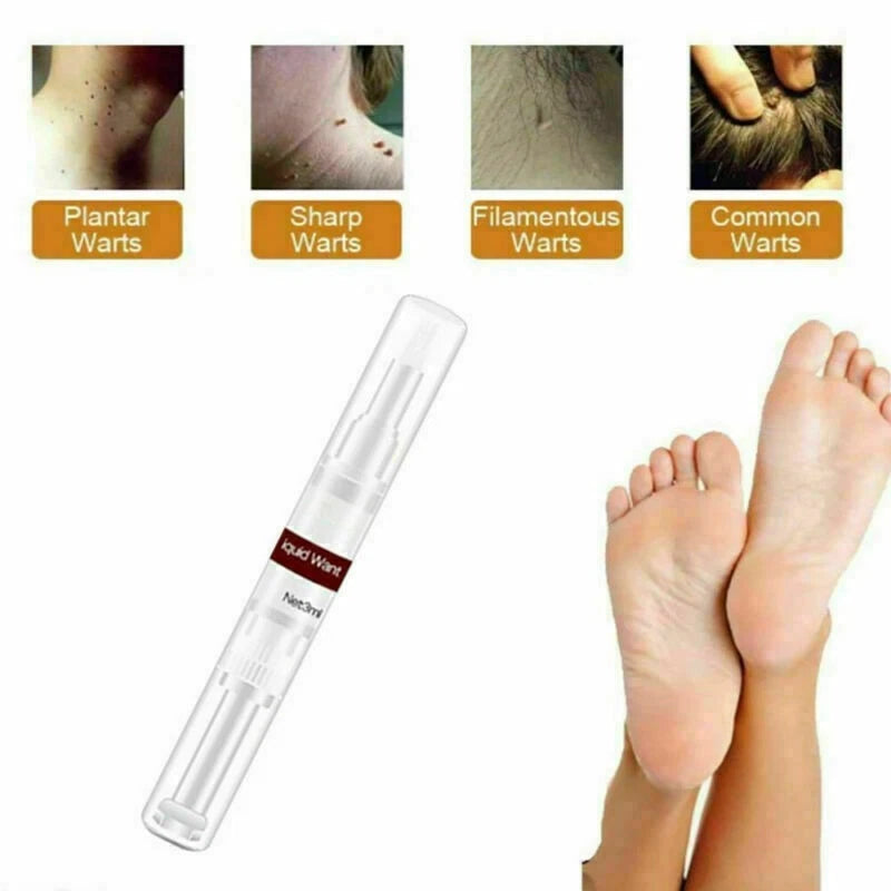 WipeOff™ Skin Tags & Moles Warts Corn Remover - Restore Skin Health and Beauty