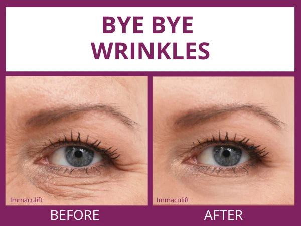 INSTANT WRINKLE Eye Tightener Cream Wrinkle Remover Serum with Argireline