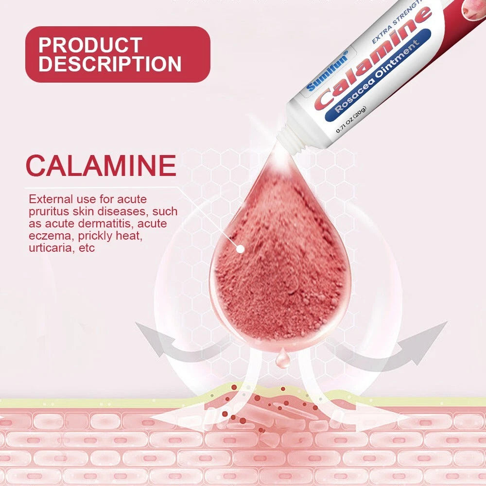 New 20g Rosacea Ointment Treat Red Nose Acne Cream Pimple Scar Repair Skin Care