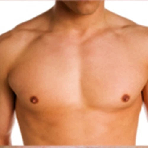 V55 Salicylic Acid Cream Spot Treatment Blackheads Blemishes Problem Skin Spots