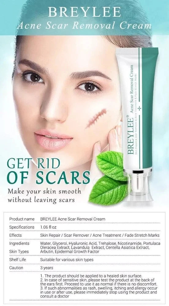 Breylee Acne Scar Removal Cream 30G Face Cream Skin Repair Skin Care Scar Acne