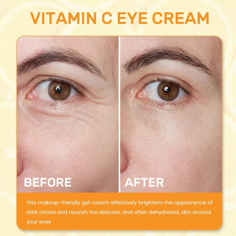 Vitamin C Eye Cream - Brighten, Anti-Aging, Dark Circles & Puffiness Treatment