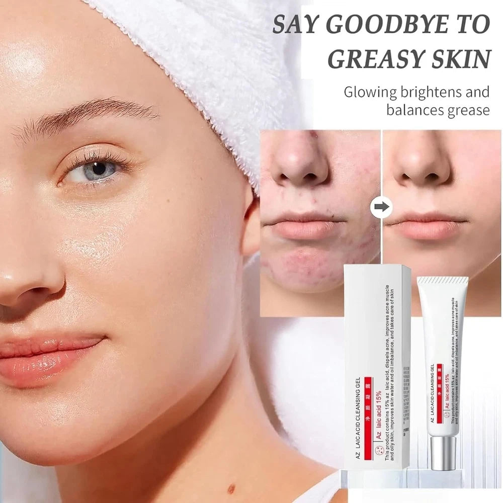Aze-laic Acid 15% Acne Tratment Gel,15% Acid Acne Treatment Gel for Face,Azel-a
